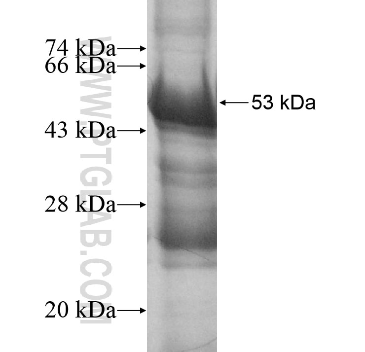 CRISP3 fusion protein Ag12805 SDS-PAGE