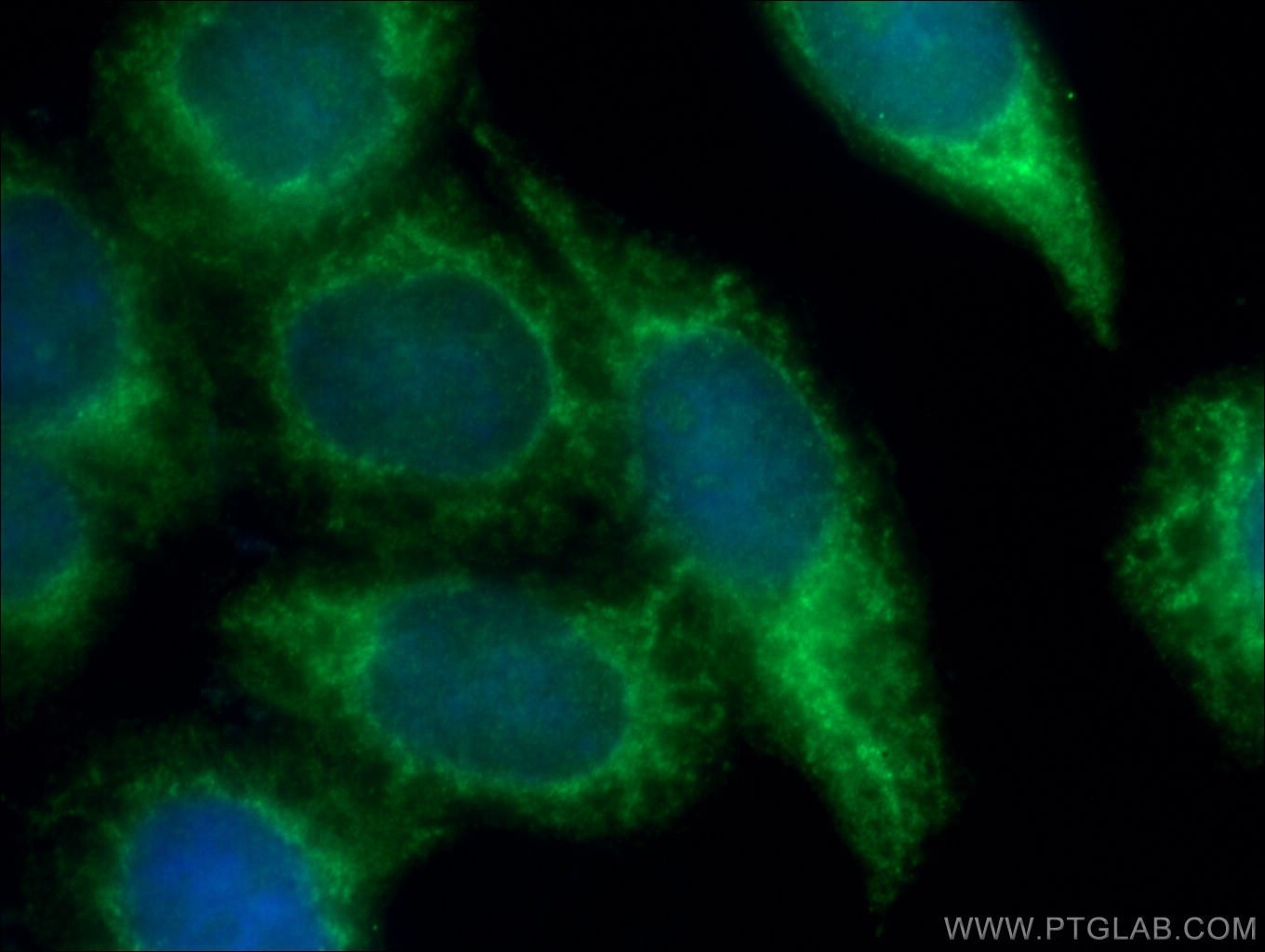 Immunofluorescence (IF) / fluorescent staining of HeLa cells using CRK Polyclonal antibody (16685-1-AP)