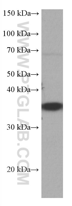 Western Blot (WB) analysis of Jurkat cells using CRK Monoclonal antibody (67035-1-Ig)