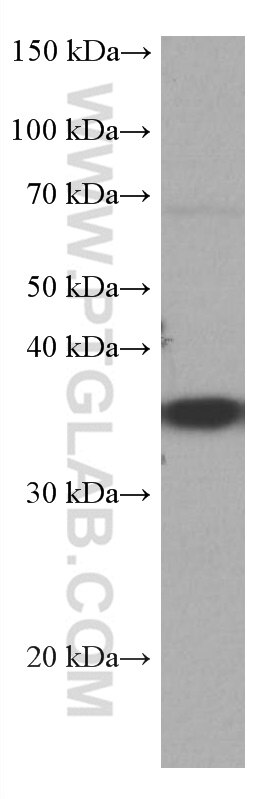 WB analysis of Jurkat using 67035-1-Ig