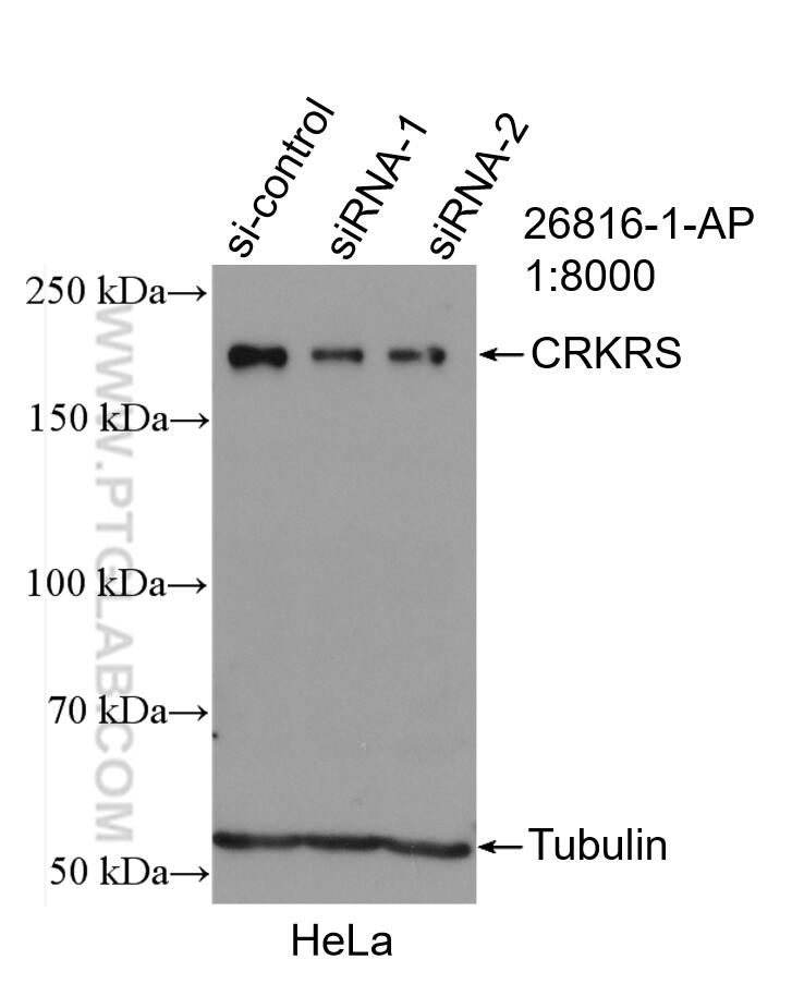 Western Blot (WB) analysis of HeLa cells using CDK12/CRKRS Polyclonal antibody (26816-1-AP)