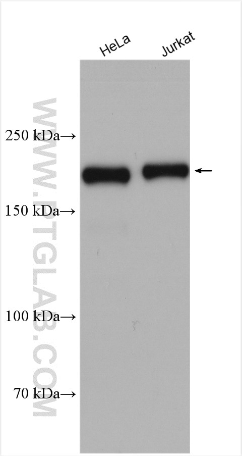 Western Blot (WB) analysis of various lysates using CDK12/CRKRS Polyclonal antibody (26816-1-AP)