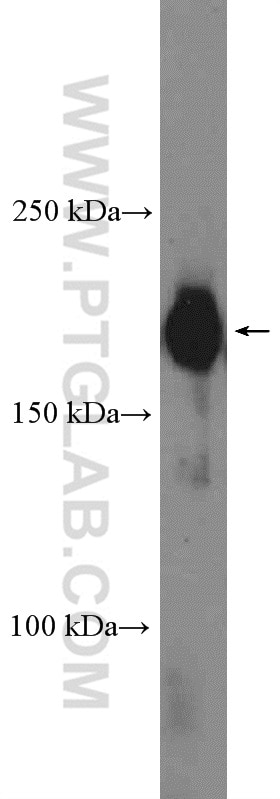 Western Blot (WB) analysis of K-562 cells using CDK12/CRKRS Polyclonal antibody (26816-1-AP)