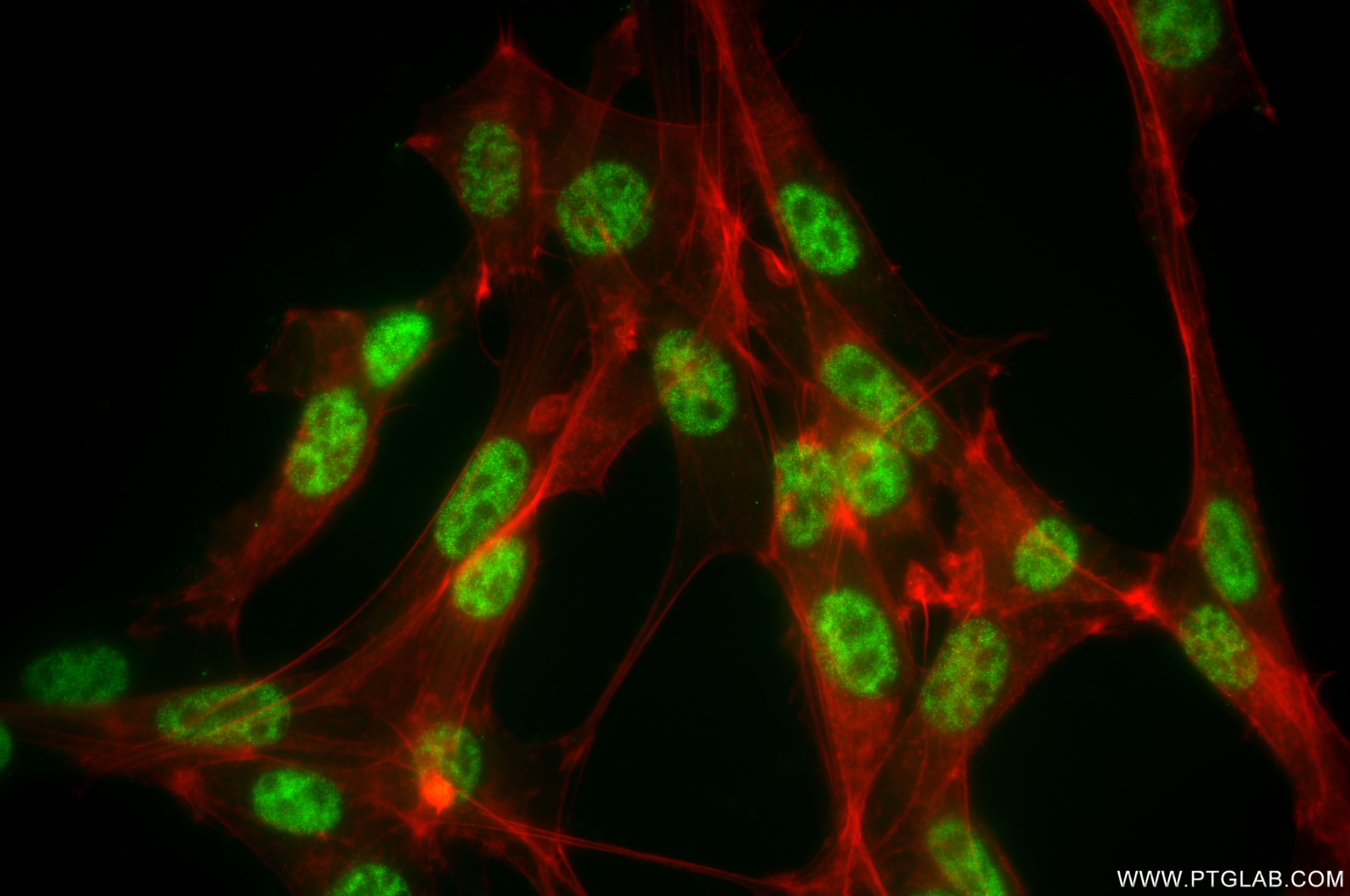 Immunofluorescence (IF) / fluorescent staining of NIH/3T3 cells using CDK12/CRKRS Recombinant antibody (86296-3-RR)