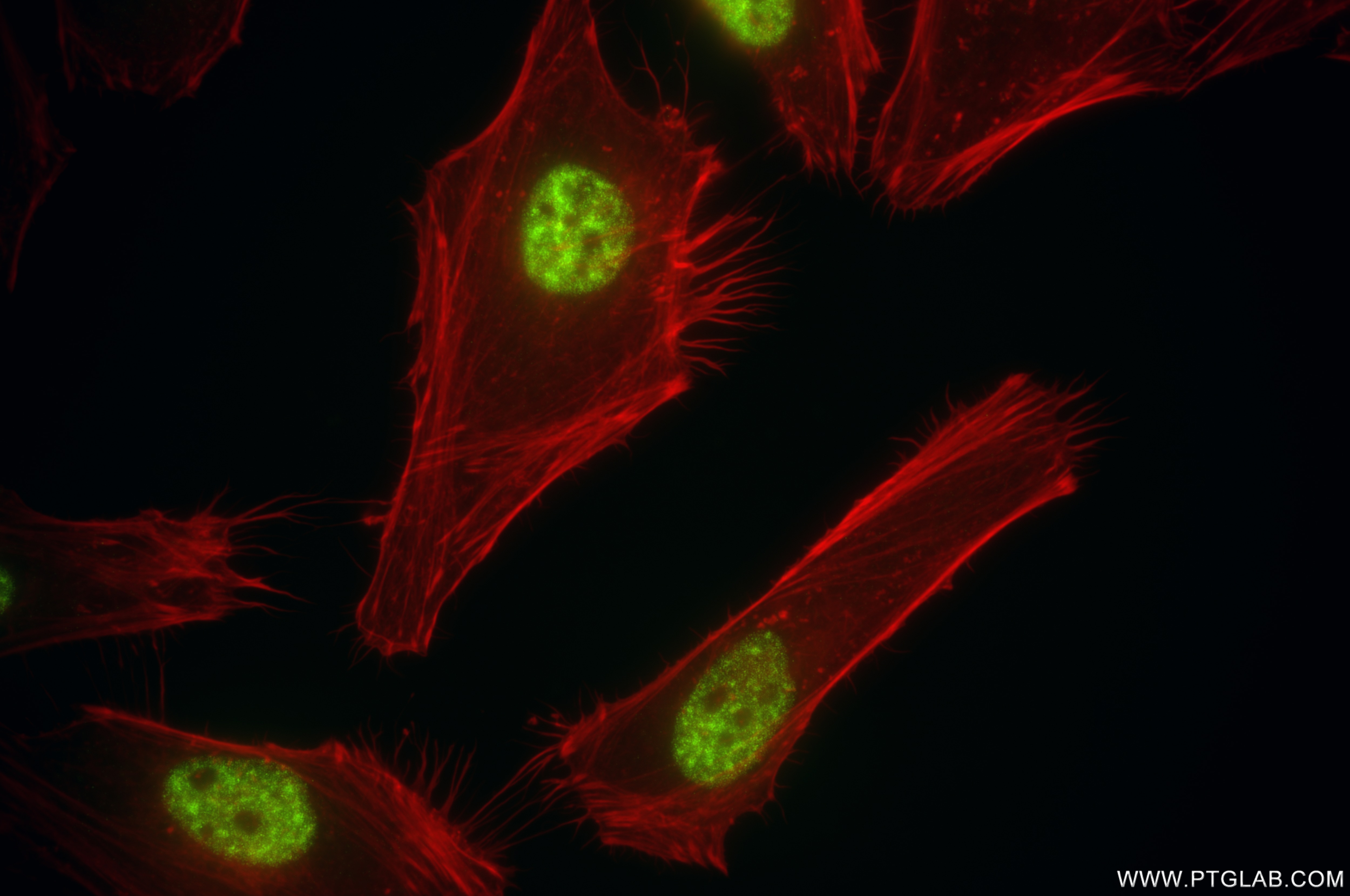 Immunofluorescence (IF) / fluorescent staining of HeLa cells using CDK12/CRKRS Recombinant antibody (86296-3-RR)