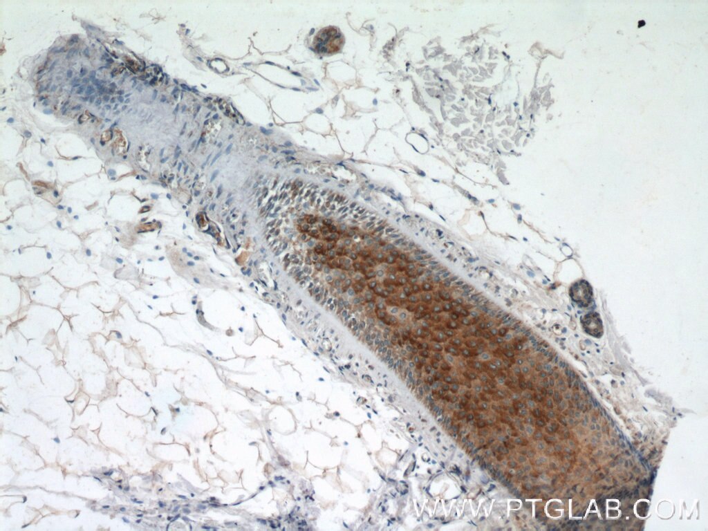 Immunohistochemistry (IHC) staining of human skin tissue using CRLF1 Polyclonal antibody (17027-1-AP)