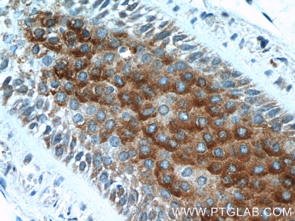 Immunohistochemistry (IHC) staining of human skin tissue using CRLF1 Polyclonal antibody (17027-1-AP)