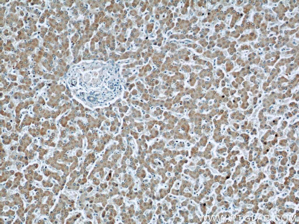 Immunohistochemistry (IHC) staining of human liver tissue using CRLF1 Polyclonal antibody (17027-1-AP)