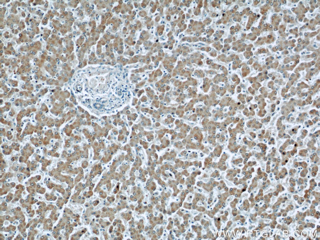 IHC staining of human liver using 17027-1-AP