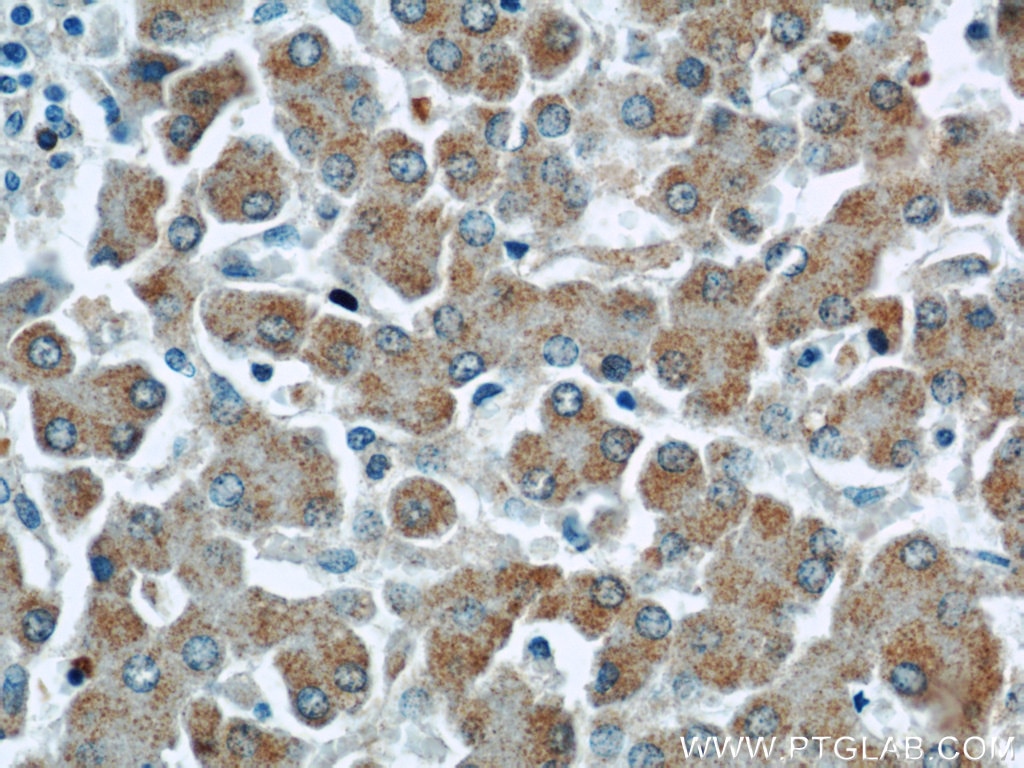 IHC staining of human liver using 17027-1-AP