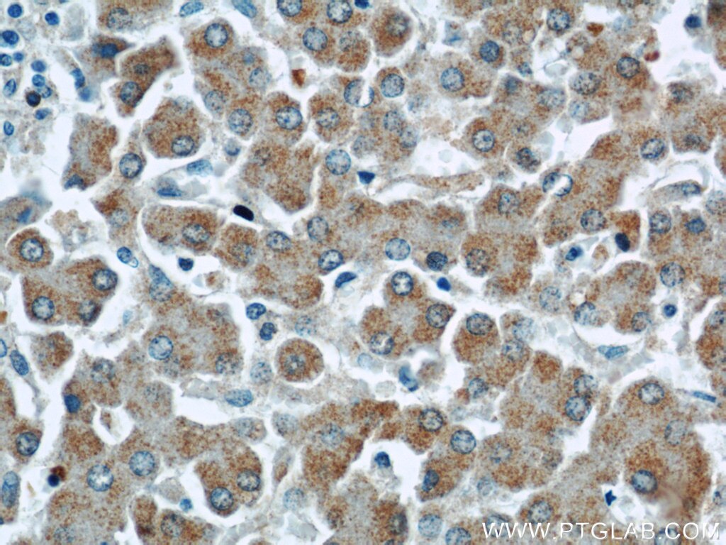 Immunohistochemistry (IHC) staining of human liver tissue using CRLF1 Polyclonal antibody (17027-1-AP)