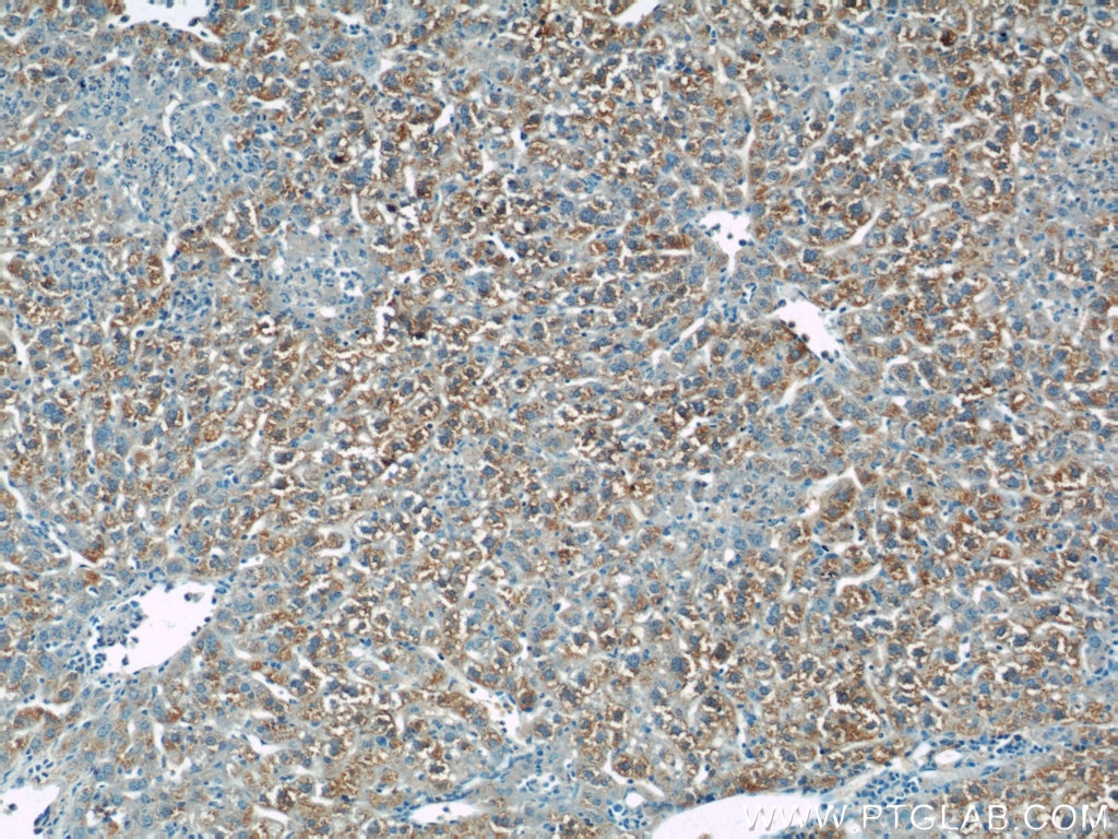 IHC staining of mouse liver using 17027-1-AP
