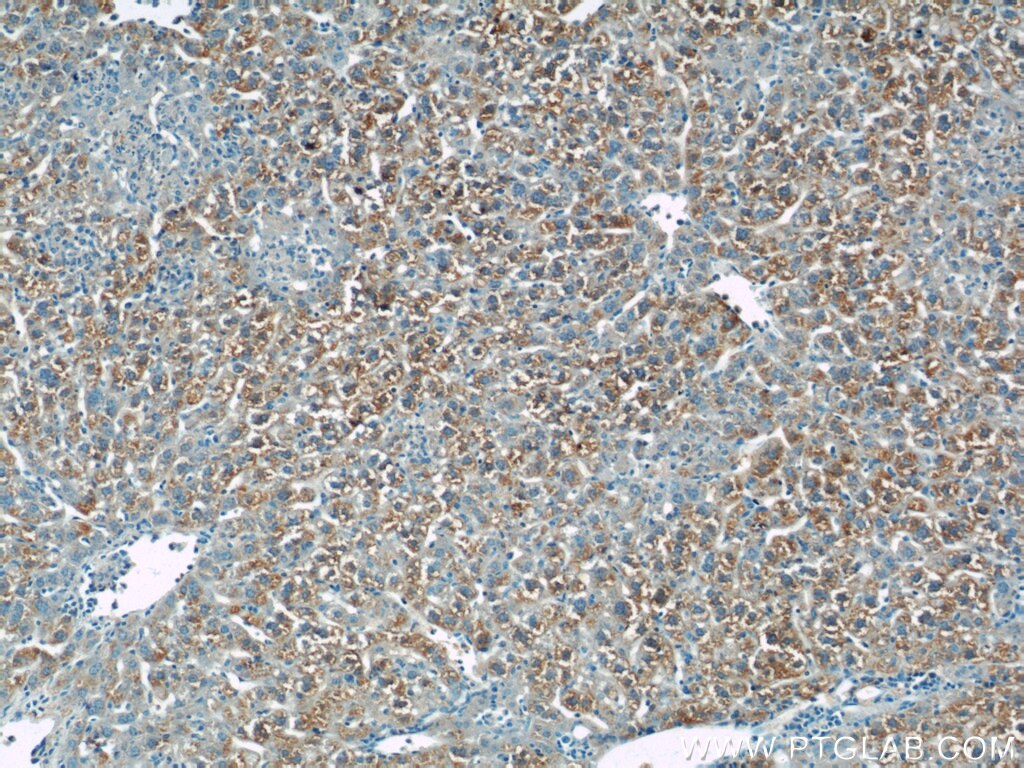 Immunohistochemistry (IHC) staining of mouse liver tissue using CRLF1 Polyclonal antibody (17027-1-AP)