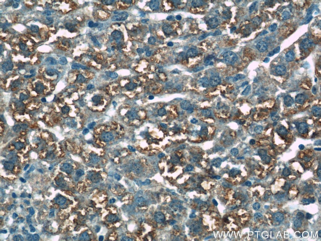 Immunohistochemistry (IHC) staining of mouse liver tissue using CRLF1 Polyclonal antibody (17027-1-AP)