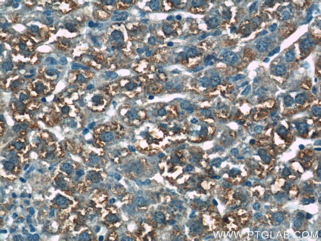 IHC staining of mouse liver using 17027-1-AP