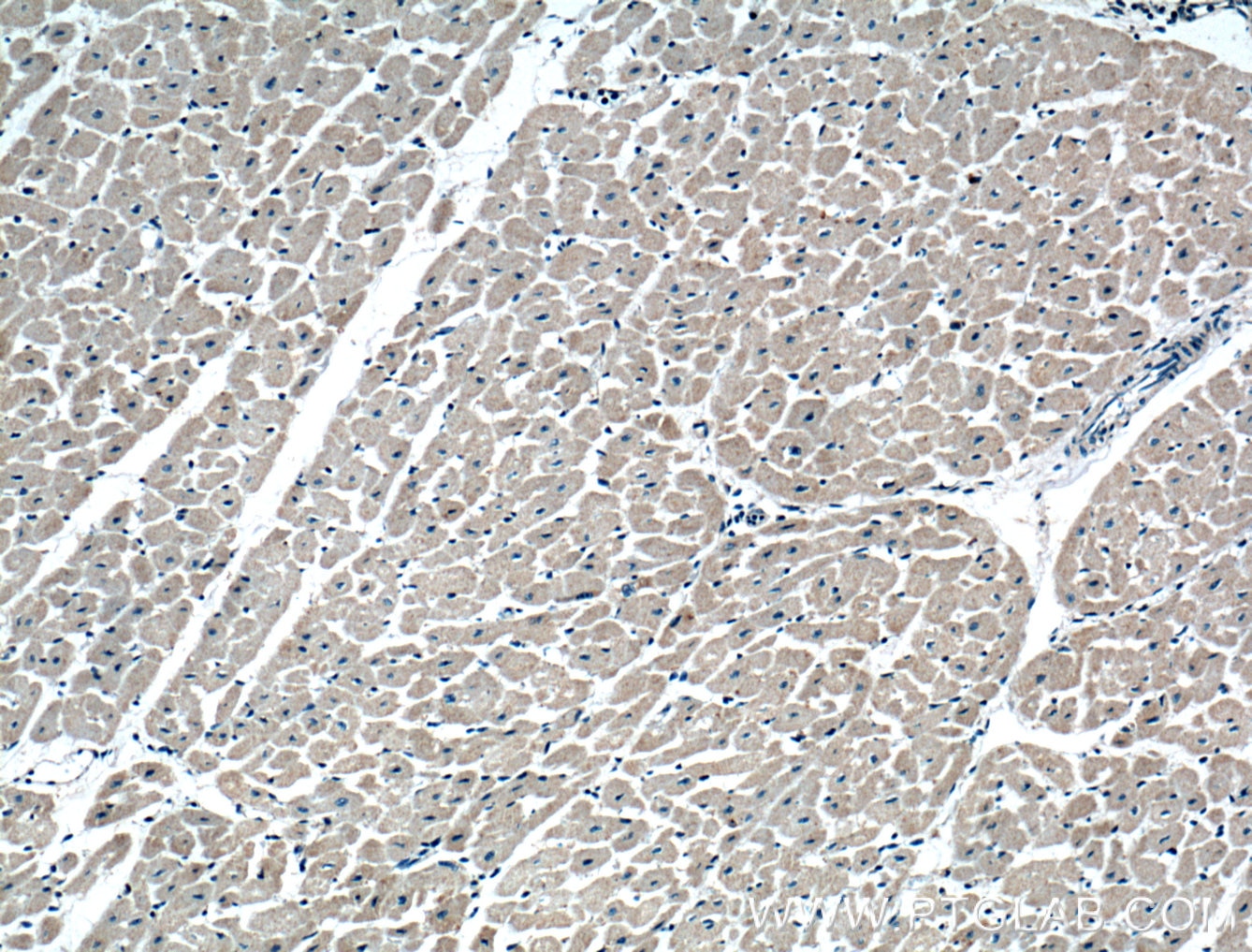 Immunohistochemistry (IHC) staining of human heart tissue using CRLS1 Polyclonal antibody (51055-1-AP)