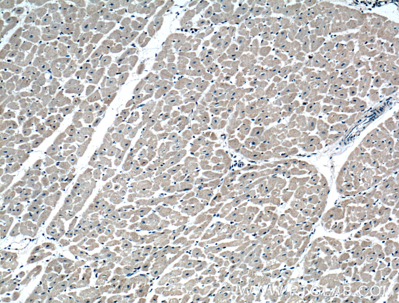 Immunohistochemistry (IHC) staining of human heart tissue using CRLS1 Polyclonal antibody (51055-1-AP)