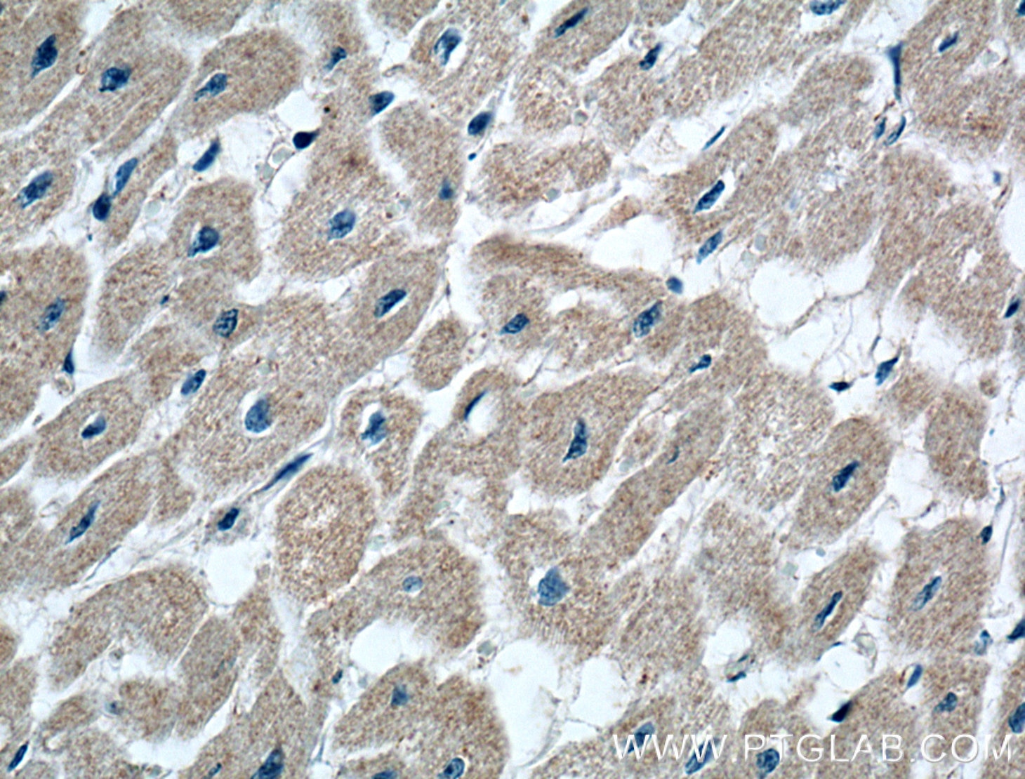 Immunohistochemistry (IHC) staining of human heart tissue using CRLS1 Polyclonal antibody (51055-1-AP)