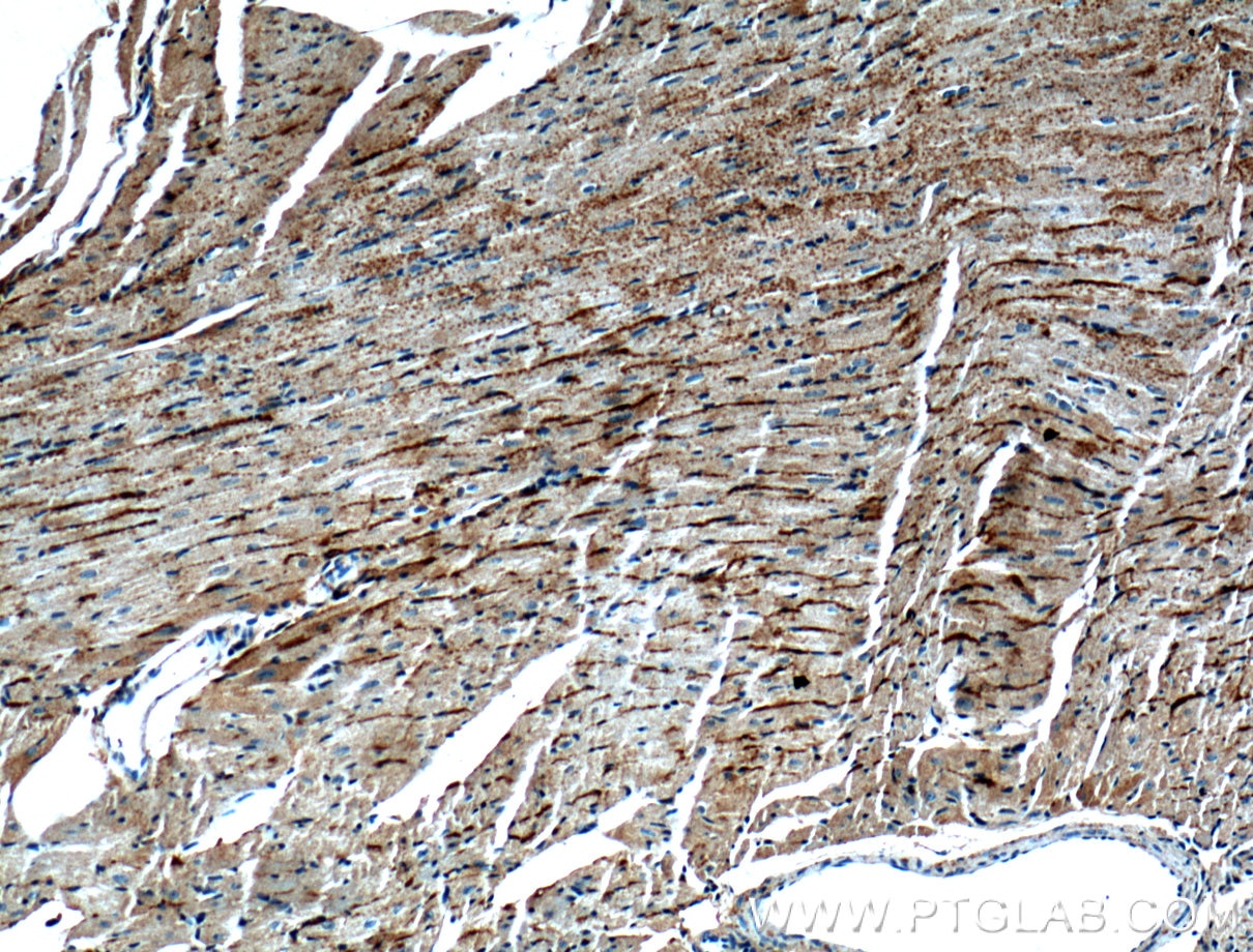 Immunohistochemistry (IHC) staining of mouse heart tissue using CRLS1 Polyclonal antibody (51055-1-AP)