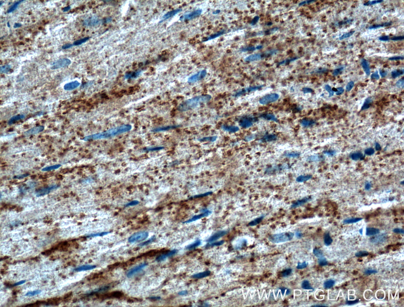 Immunohistochemistry (IHC) staining of mouse heart tissue using CRLS1 Polyclonal antibody (51055-1-AP)