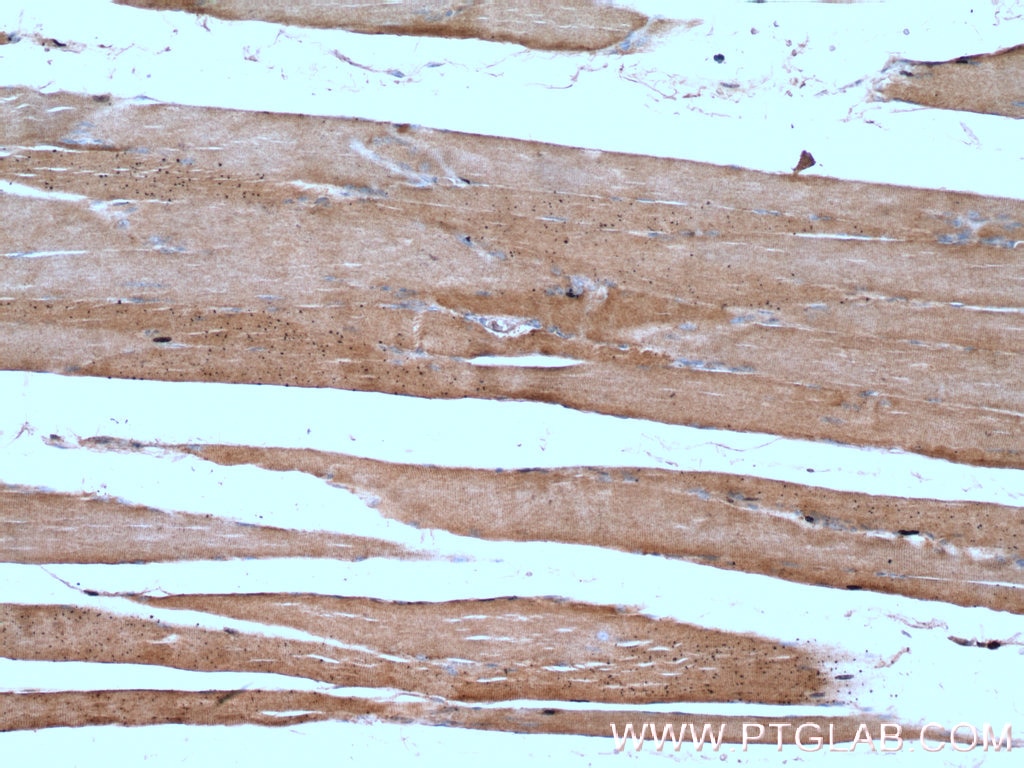 Immunohistochemistry (IHC) staining of human skeletal muscle tissue using CRLS1-Specific Polyclonal antibody (14845-1-AP)