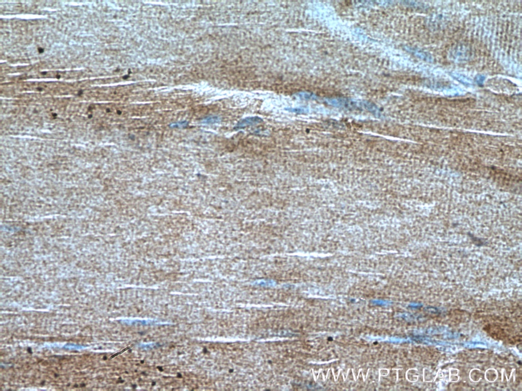 IHC staining of human skeletal muscle using 14845-1-AP