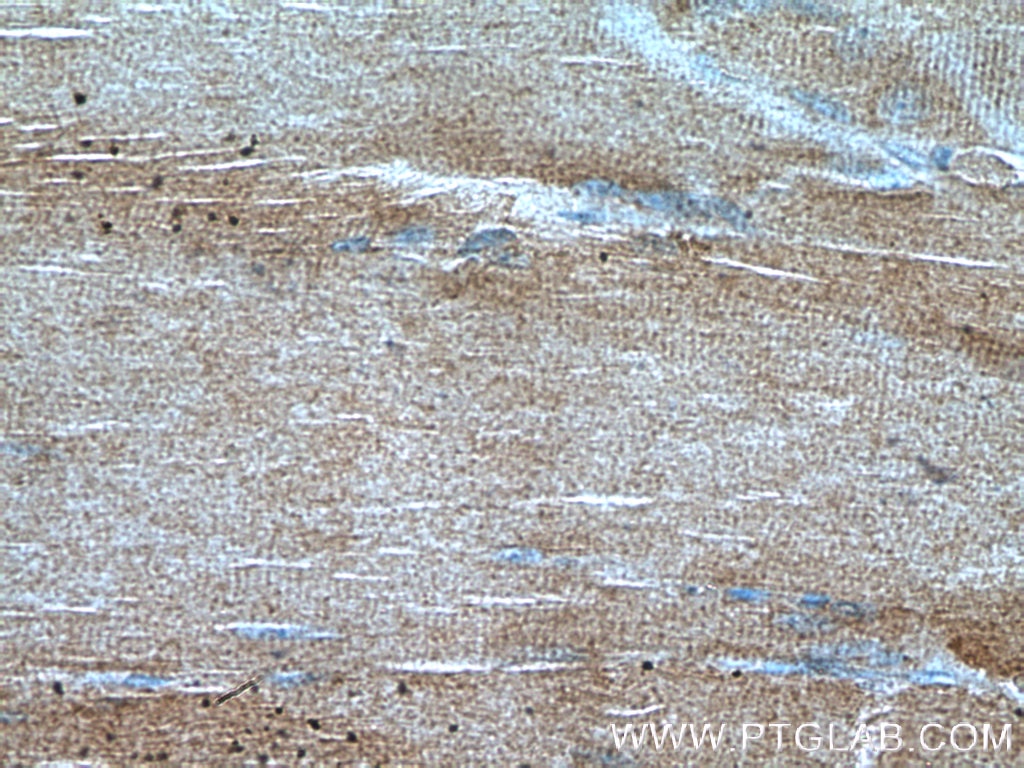 Immunohistochemistry (IHC) staining of human skeletal muscle tissue using CRLS1-Specific Polyclonal antibody (14845-1-AP)