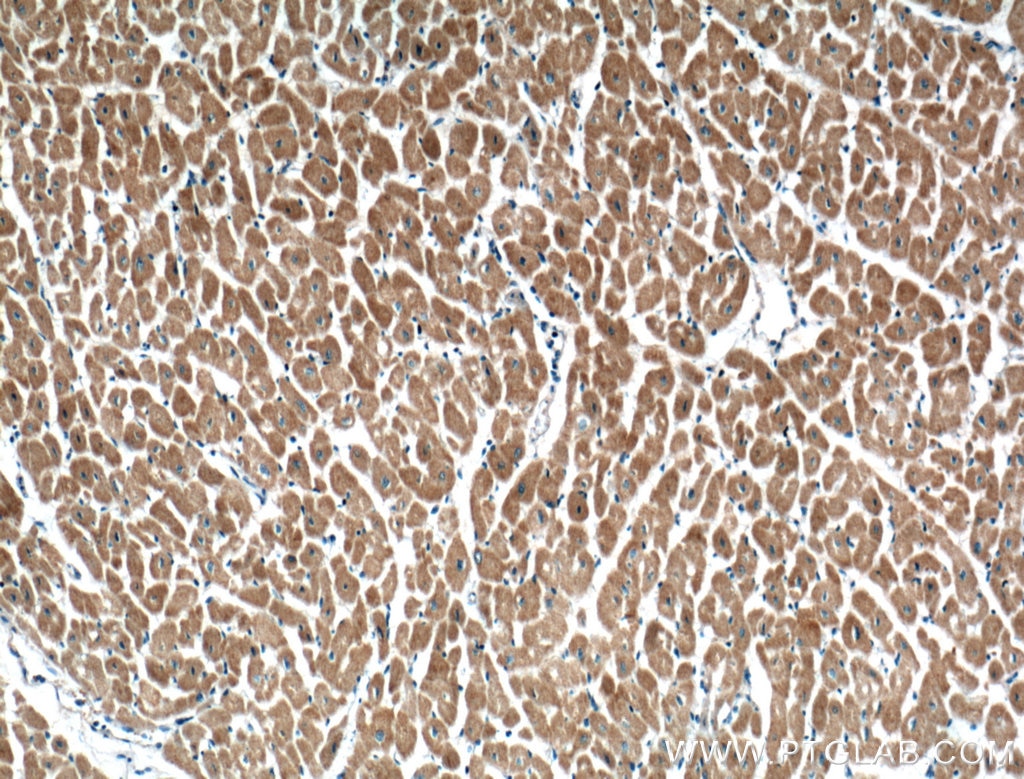 Immunohistochemistry (IHC) staining of human heart tissue using CRLS1-Specific Polyclonal antibody (14845-1-AP)
