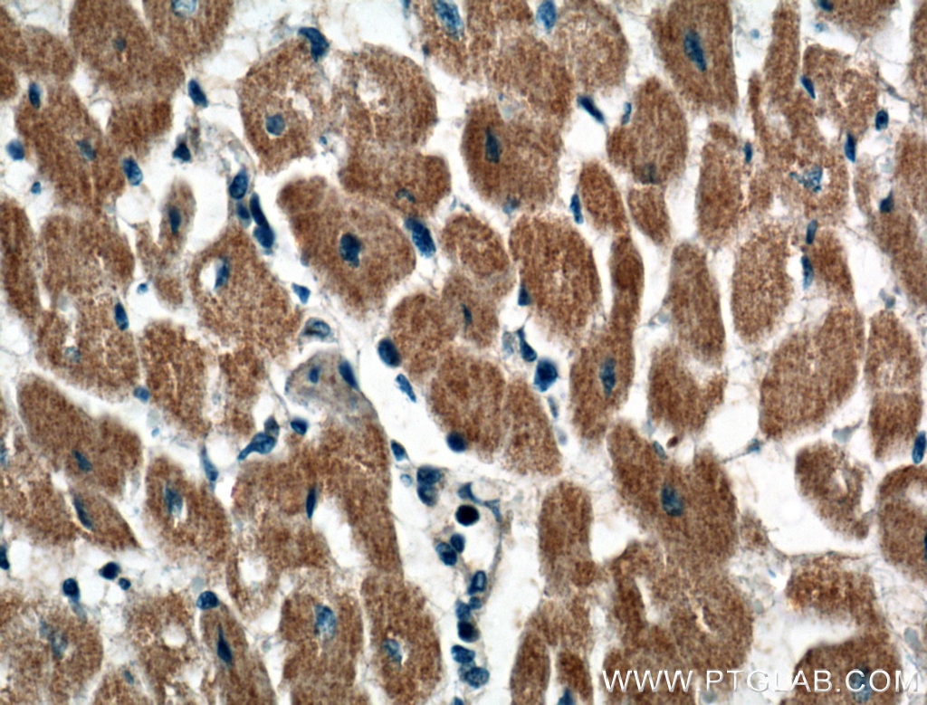 Immunohistochemistry (IHC) staining of human heart tissue using CRLS1-Specific Polyclonal antibody (14845-1-AP)