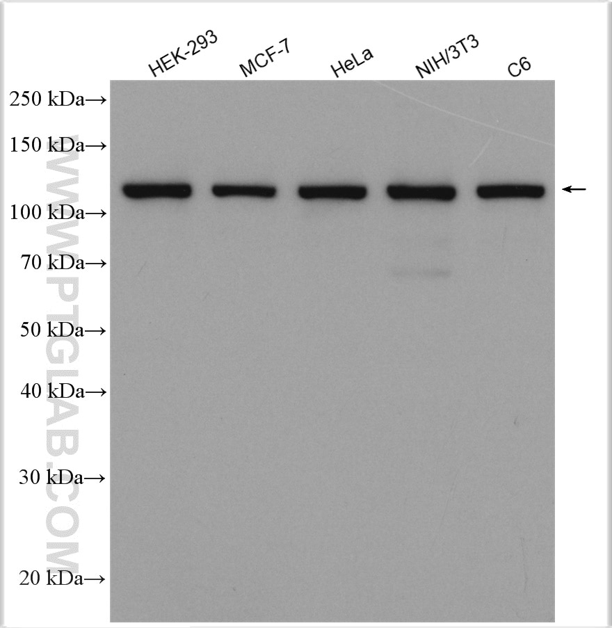 Western Blot (WB) analysis of various lysates using CRM1 Polyclonal antibody (27917-1-AP)