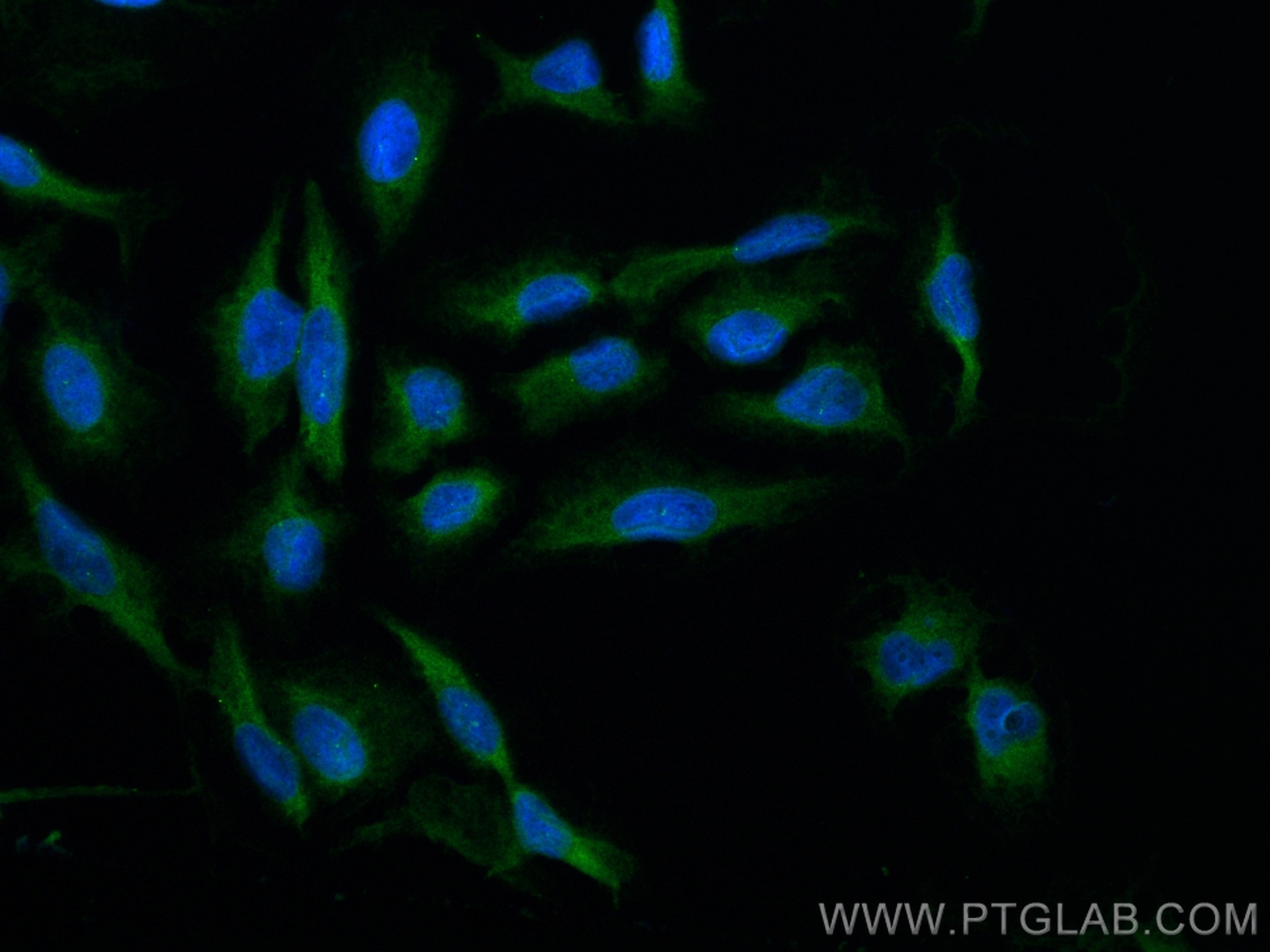Immunofluorescence (IF) / fluorescent staining of U2OS cells using CRMP1 Polyclonal antibody (10317-1-AP)