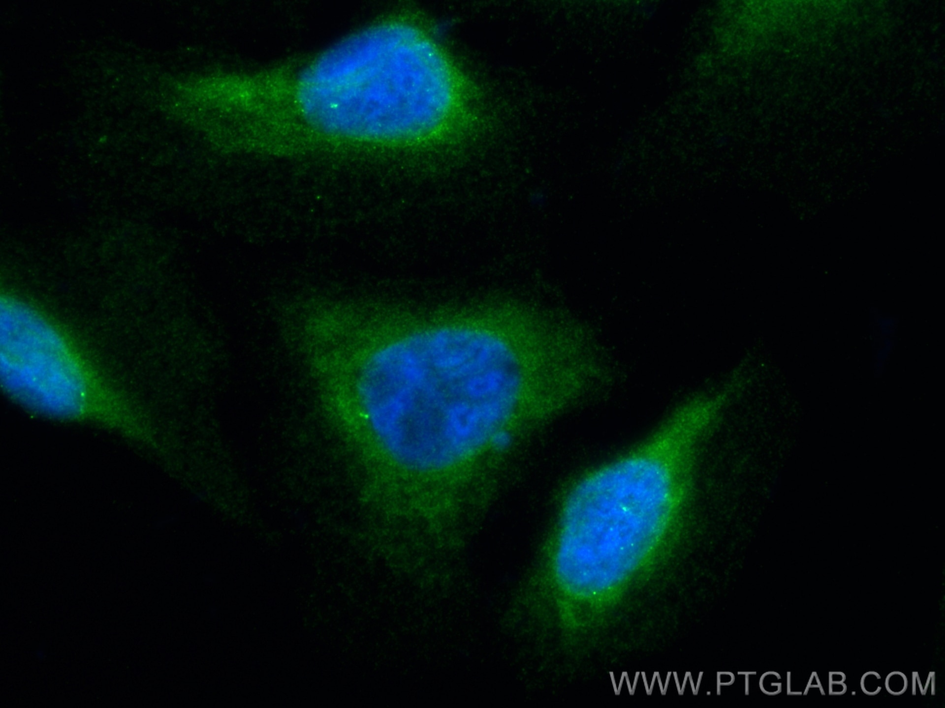 Immunofluorescence (IF) / fluorescent staining of U2OS cells using CRMP1 Polyclonal antibody (10317-1-AP)