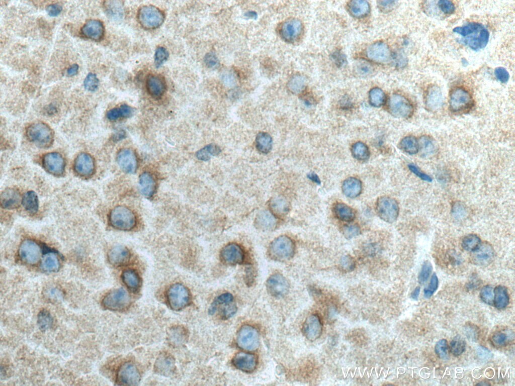 IHC staining of mouse brain using 10317-1-AP