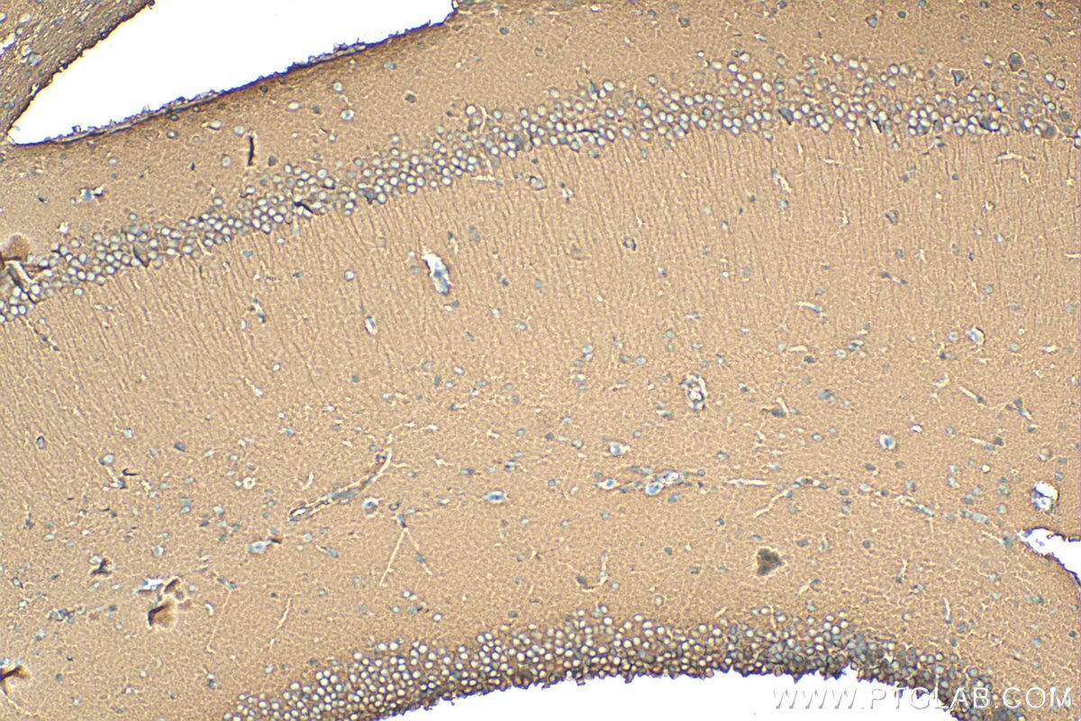 IHC staining of mouse brain using 10317-1-AP