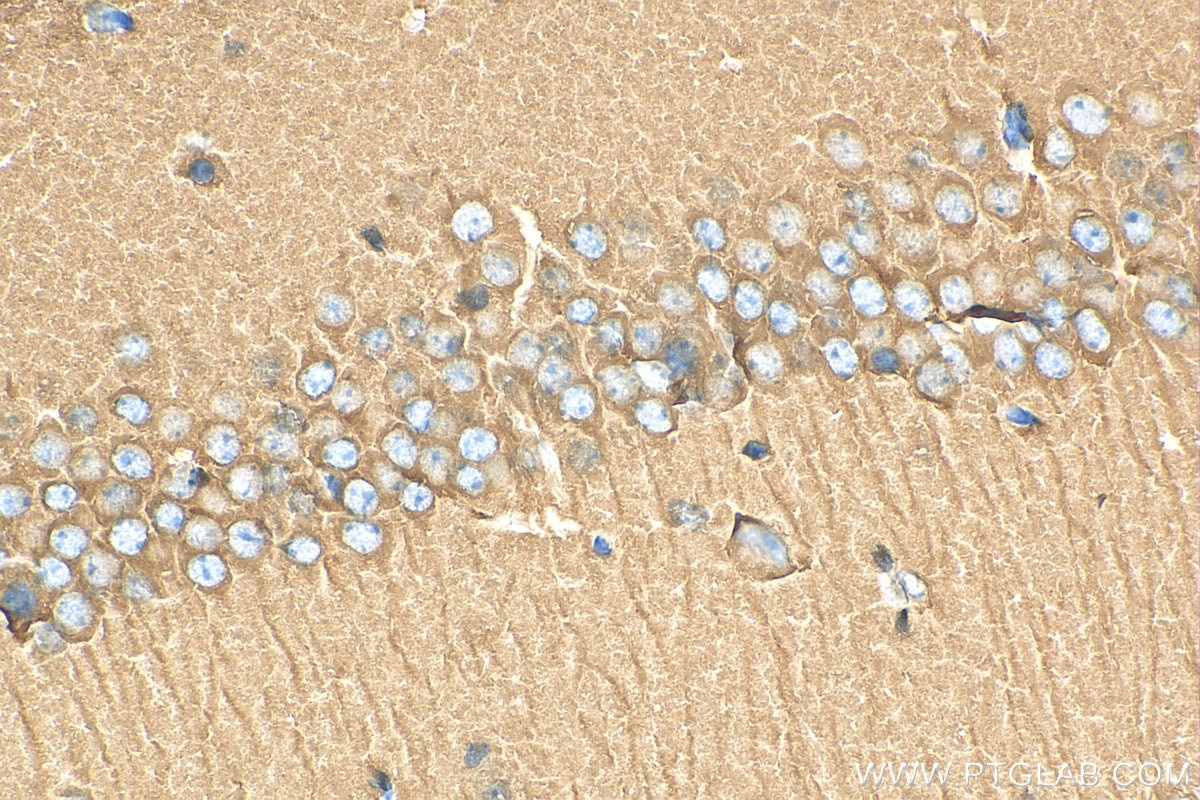 Immunohistochemistry (IHC) staining of mouse brain tissue using CRMP1 Polyclonal antibody (10317-1-AP)