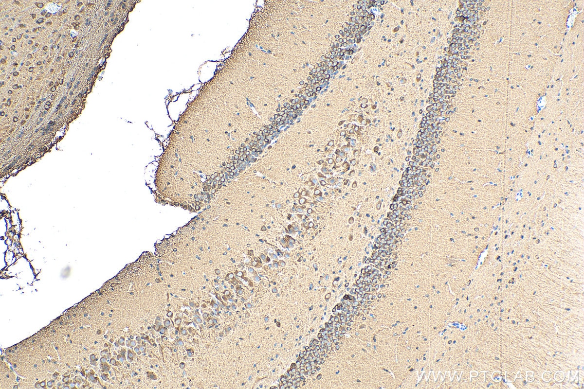 Immunohistochemistry (IHC) staining of rat brain tissue using CRMP1 Polyclonal antibody (10317-1-AP)