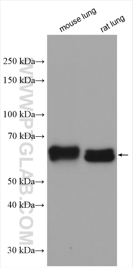 Western Blot (WB) analysis of various lysates using CRMP1 Polyclonal antibody (10317-1-AP)