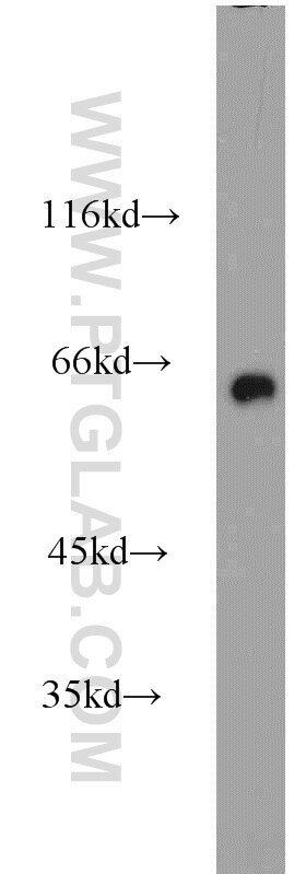 Western Blot (WB) analysis of mouse brain tissue using CRMP1 Polyclonal antibody (10317-1-AP)