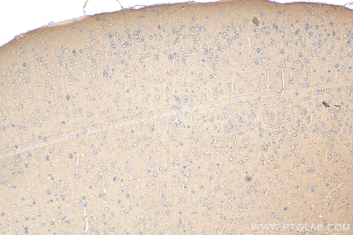 Immunohistochemistry (IHC) staining of mouse brain tissue using CRMP1 Polyclonal antibody (29497-1-AP)