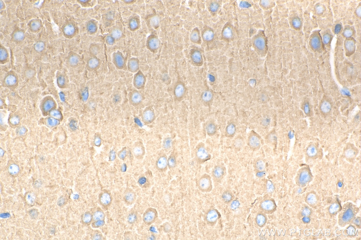 Immunohistochemistry (IHC) staining of mouse brain tissue using CRMP1 Polyclonal antibody (29497-1-AP)