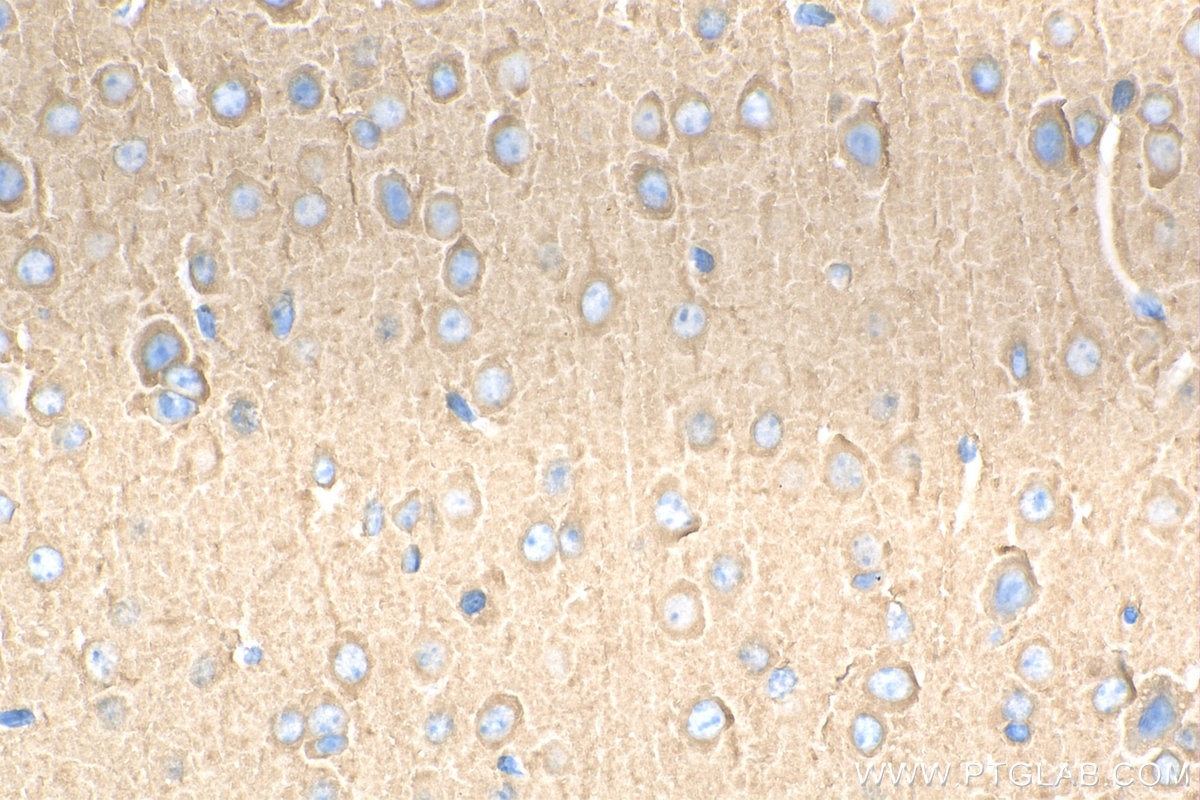 IHC staining of mouse brain using 29497-1-AP