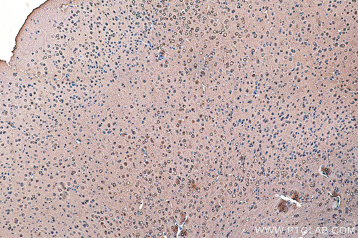 Immunohistochemistry (IHC) staining of mouse brain tissue using CRMP1 Monoclonal antibody (68021-1-Ig)