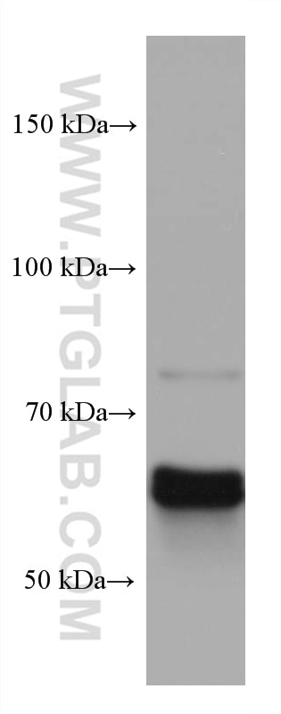 Western Blot (WB) analysis of rabbit brain tissue using CRMP1 Monoclonal antibody (68021-1-Ig)