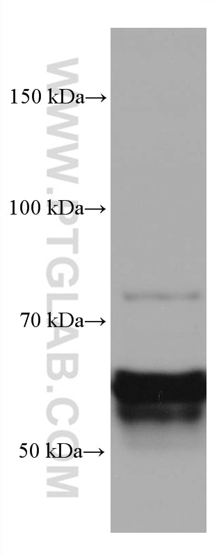 Western Blot (WB) analysis of rat brain tissue using CRMP1 Monoclonal antibody (68021-1-Ig)