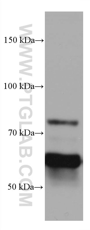 Western Blot (WB) analysis of mouse brain tissue using CRMP1 Monoclonal antibody (68021-1-Ig)