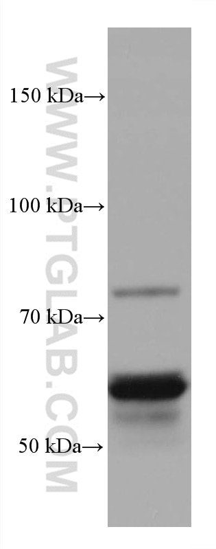 Western Blot (WB) analysis of chicken brain tissue using CRMP1 Monoclonal antibody (68021-1-Ig)