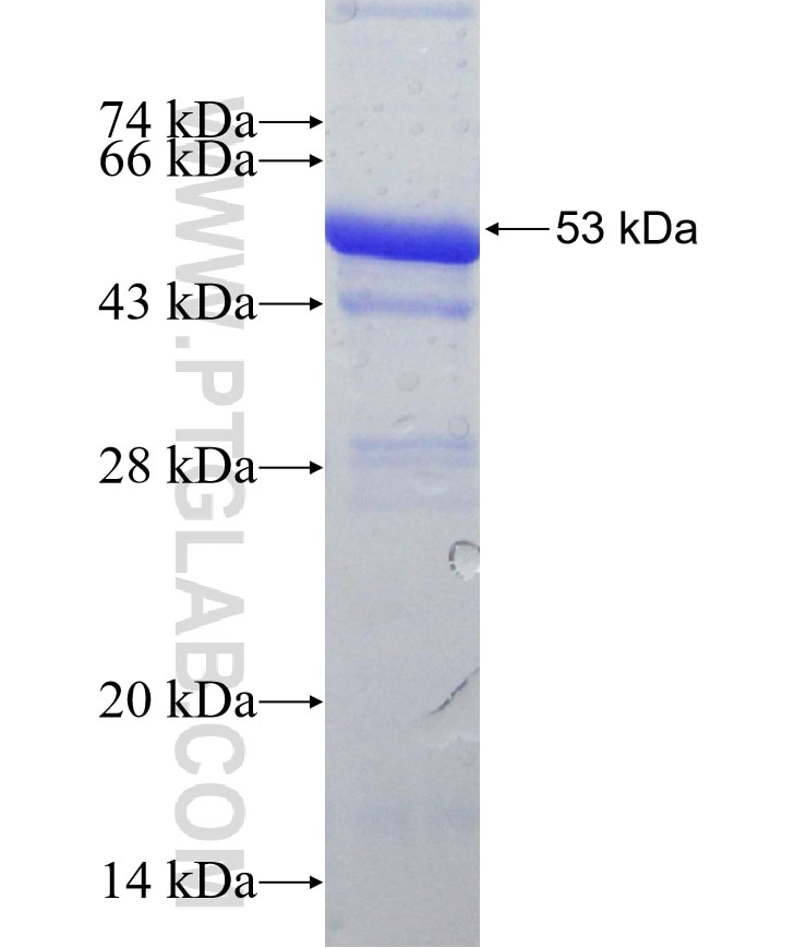 CRMP1 fusion protein Ag31559 SDS-PAGE