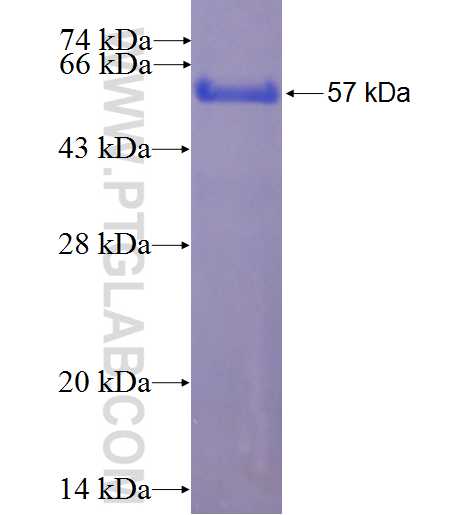 CRMP1 fusion protein Ag0369 SDS-PAGE
