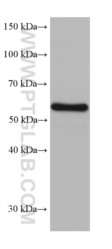 Western Blot (WB) analysis of pig brain tissue using CRMP5 Monoclonal antibody (68272-1-Ig)