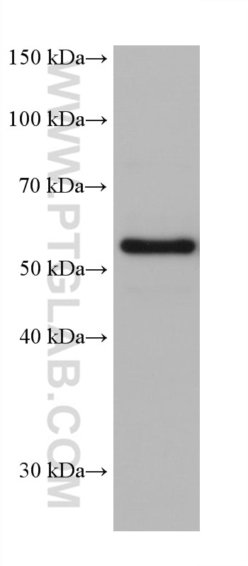 Western Blot (WB) analysis of rabbit cerebellum tissue using CRMP5 Monoclonal antibody (68272-1-Ig)